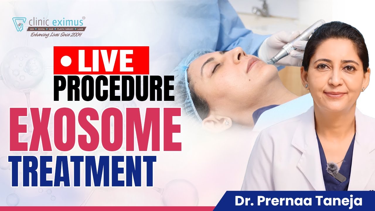 Exosome Treatment (Live Procedure) | Best Skin Treatment | Clinic Eximus