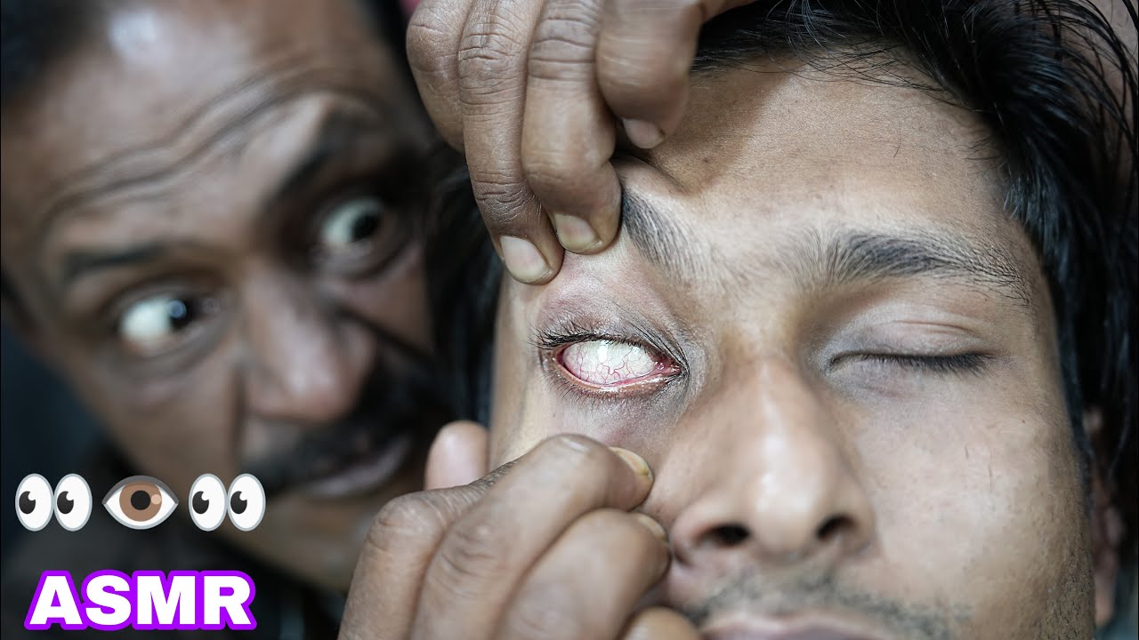 Eye Massage And Eyelid Cracking By Big Eyes Barber | ASMR Eye Massage | ASMR Forehead Massage