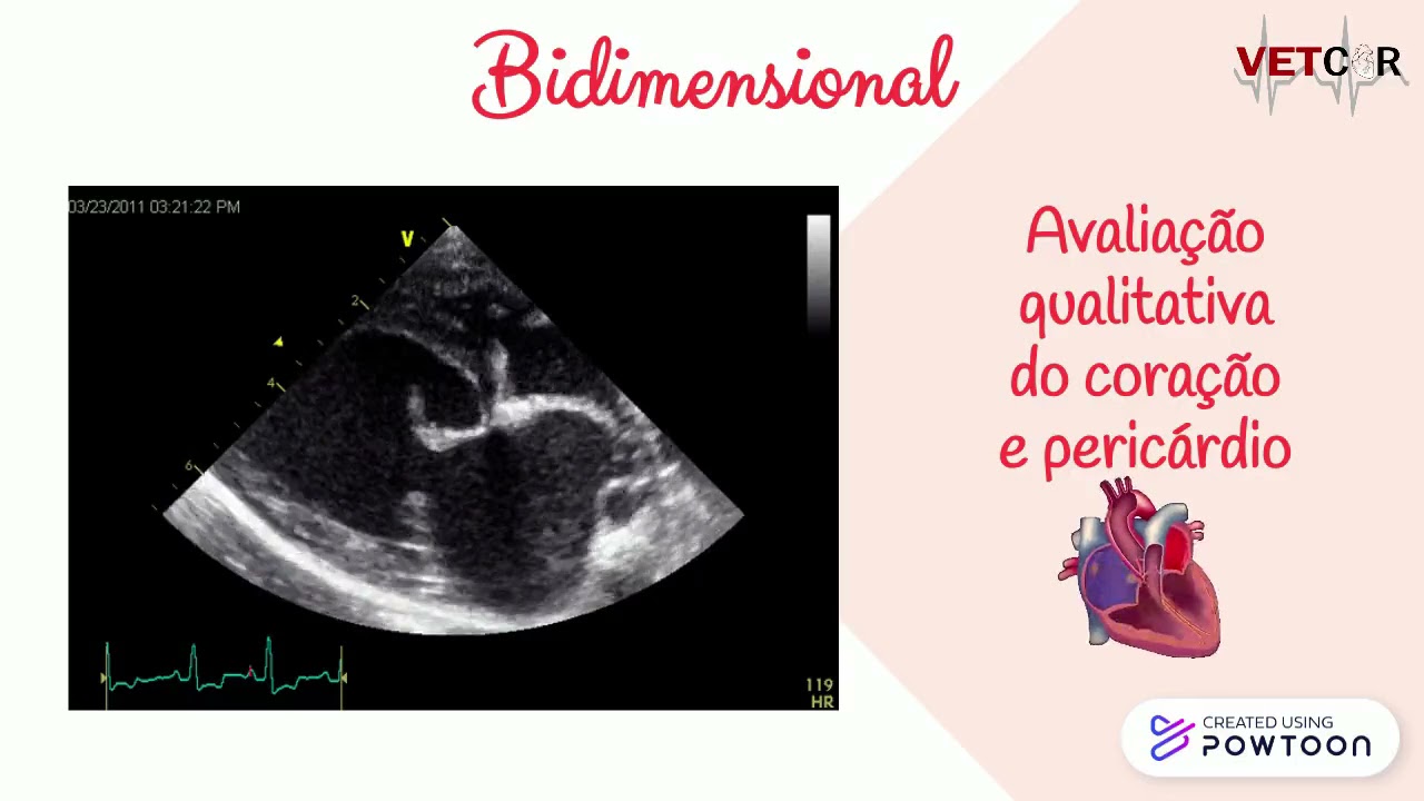 Ecocardiografia