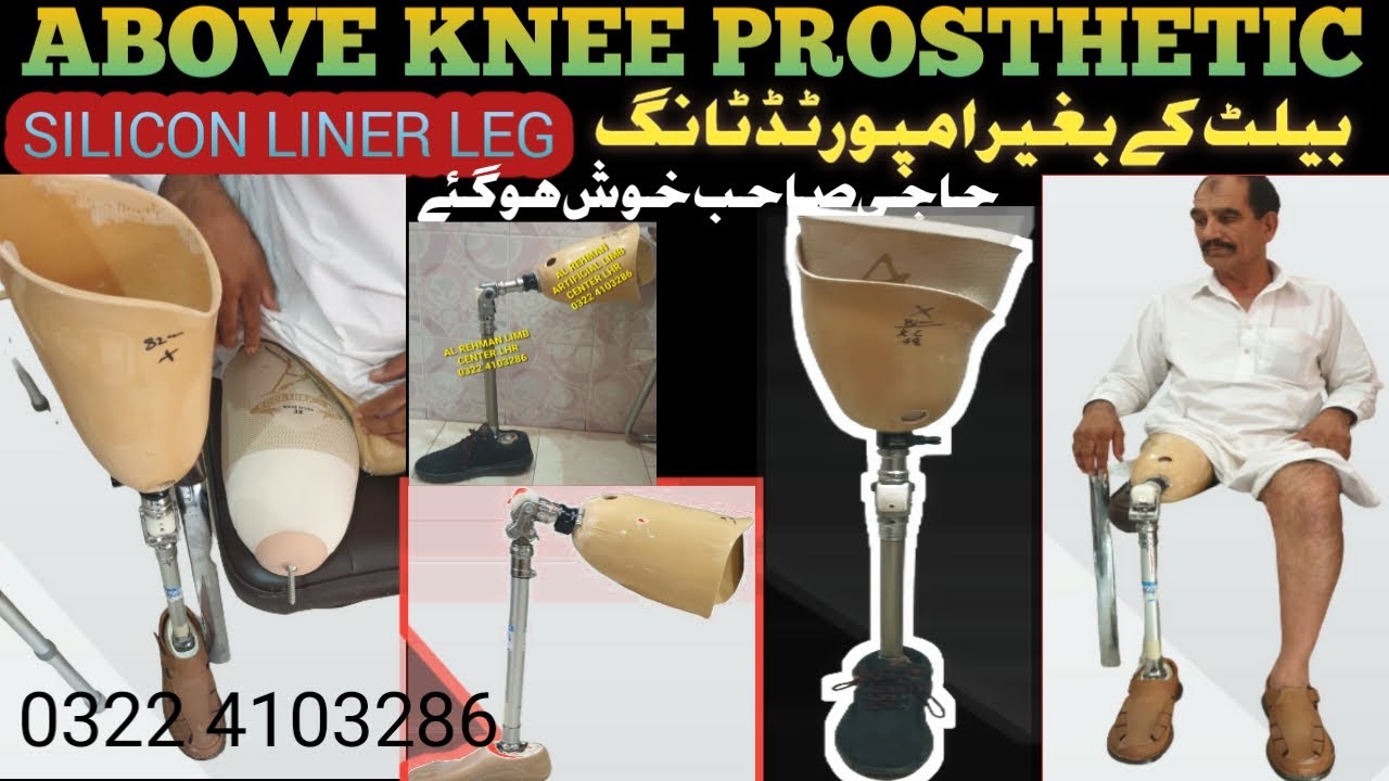 ABOVE KNEE PROSTHESIS silicon liner ARTIFICIAL leg  بیلٹ کے بغیر ٹانگ #alps #usa#silicone #ottobock