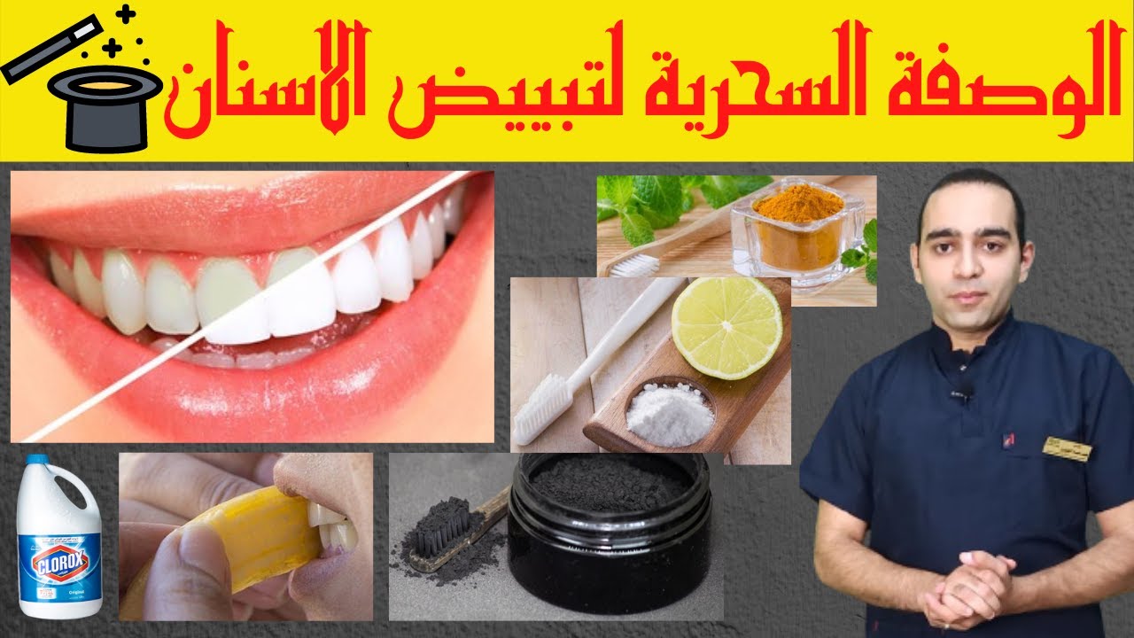طرق تبييض الاسنان في المنزل | وصفات سحرية ولكن ! | اسباب اصفرار الاسنان | كيف تحافظ على بياض اسنانك