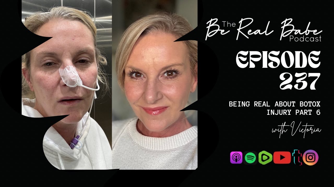 Episode 237 Being real about Botox injury #6