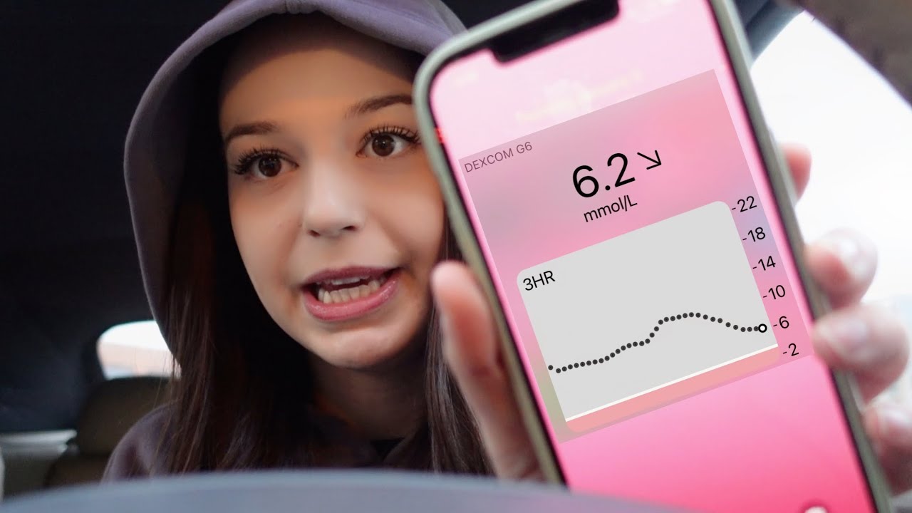 I FINALLY HAVE A DEXCOM