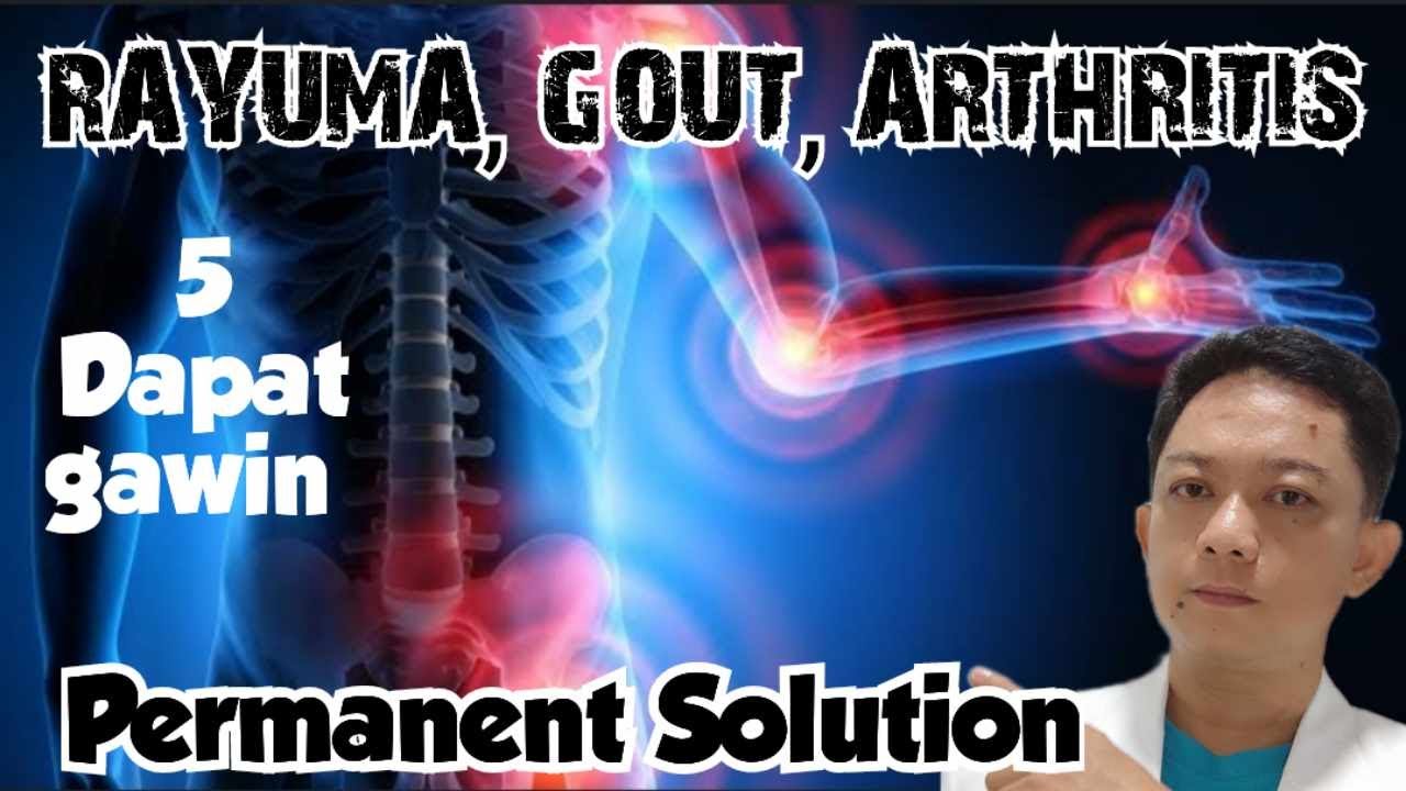 RAYUMA,GOUT ARTHRITIS,5 DAPAT GAWIN, PERMANENT SOLUTION
