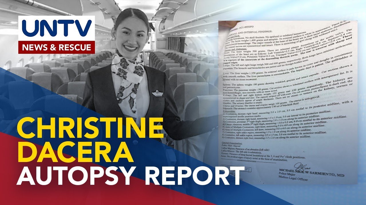 Ruptured aortic aneurysm, ikinamatay ni Christine Dacera base sa autopsy report