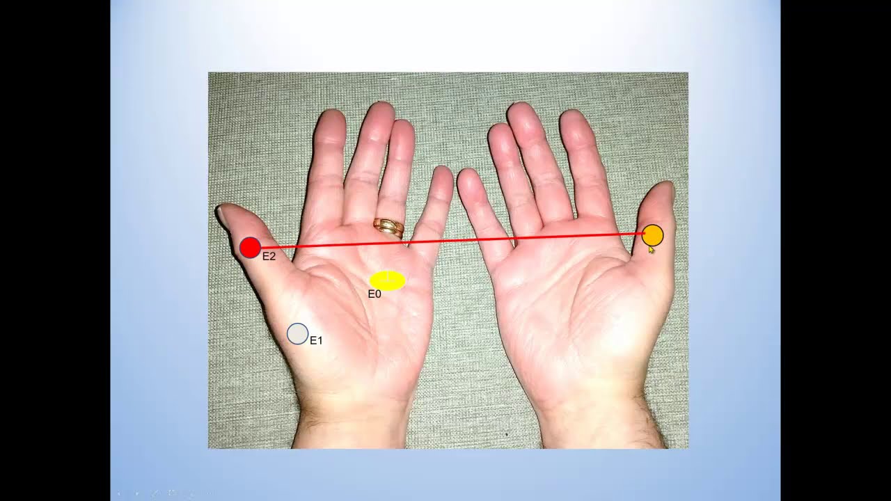 Did you think of this in Neurography?