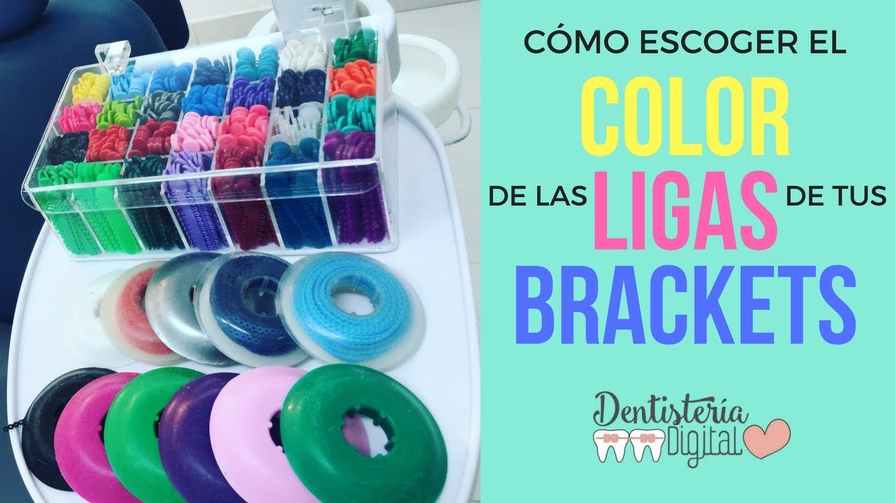 CÓMO ESCOGER EL COLOR DE LAS LIGAS DE TUS BRACKETS / How to choose the color of your braces