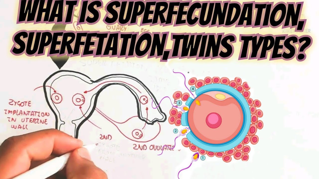 What Is Superfecundation, Superfetation,Twins Types? @umerfarooqbiology7083