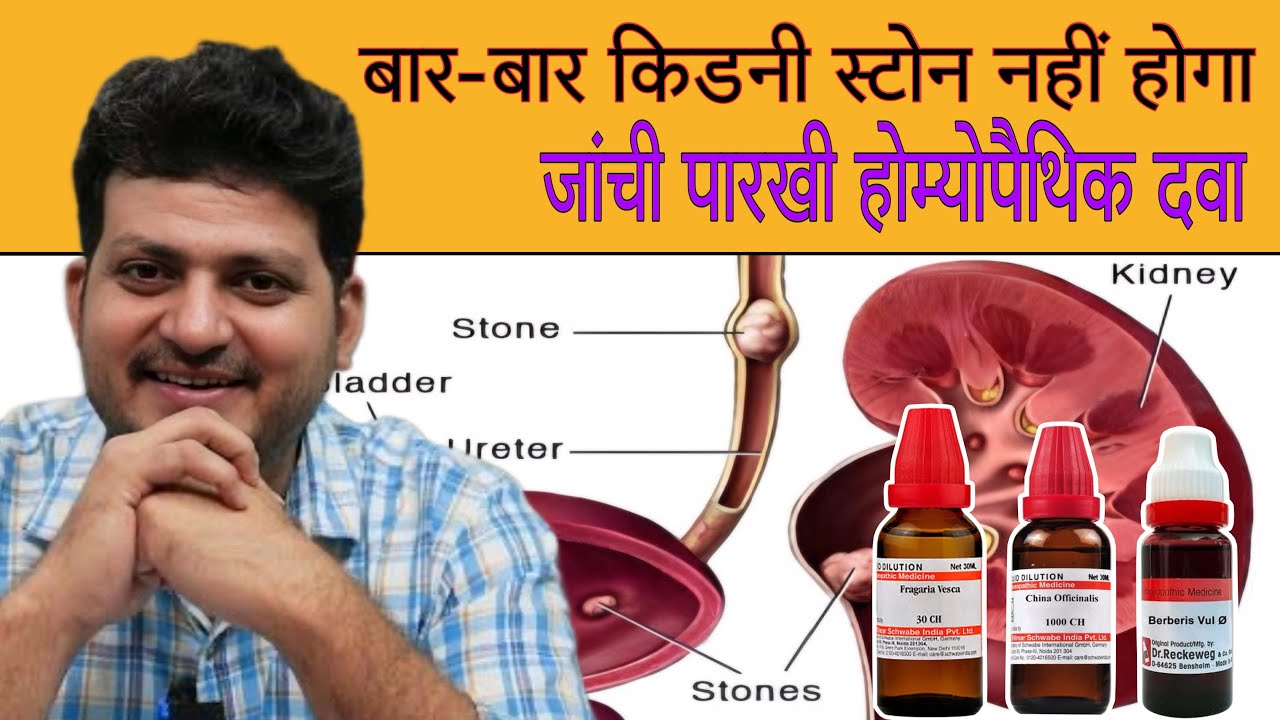बार-बार Kidney stone | Homeopathic Medicine | Recurrent kidney stones Treatment |