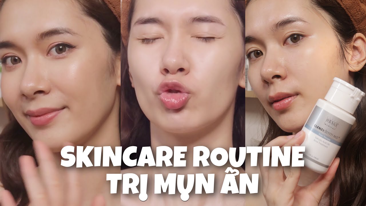 MỤN ẨN TẬP 4 | SKINCARE ROUTINE DÀNH CHO DA BỊ MỤN ẨN #bha #benzoylperoxide #combinationskin