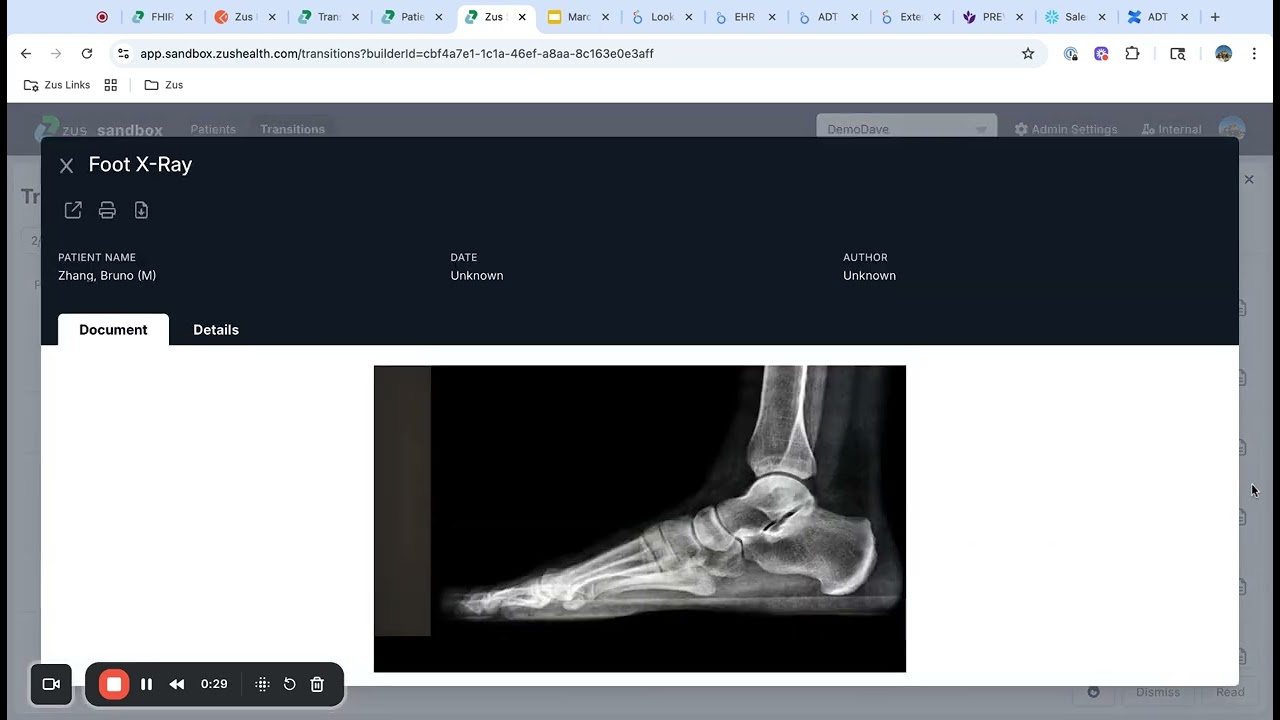 Zus Health Demo: Transitions of Care