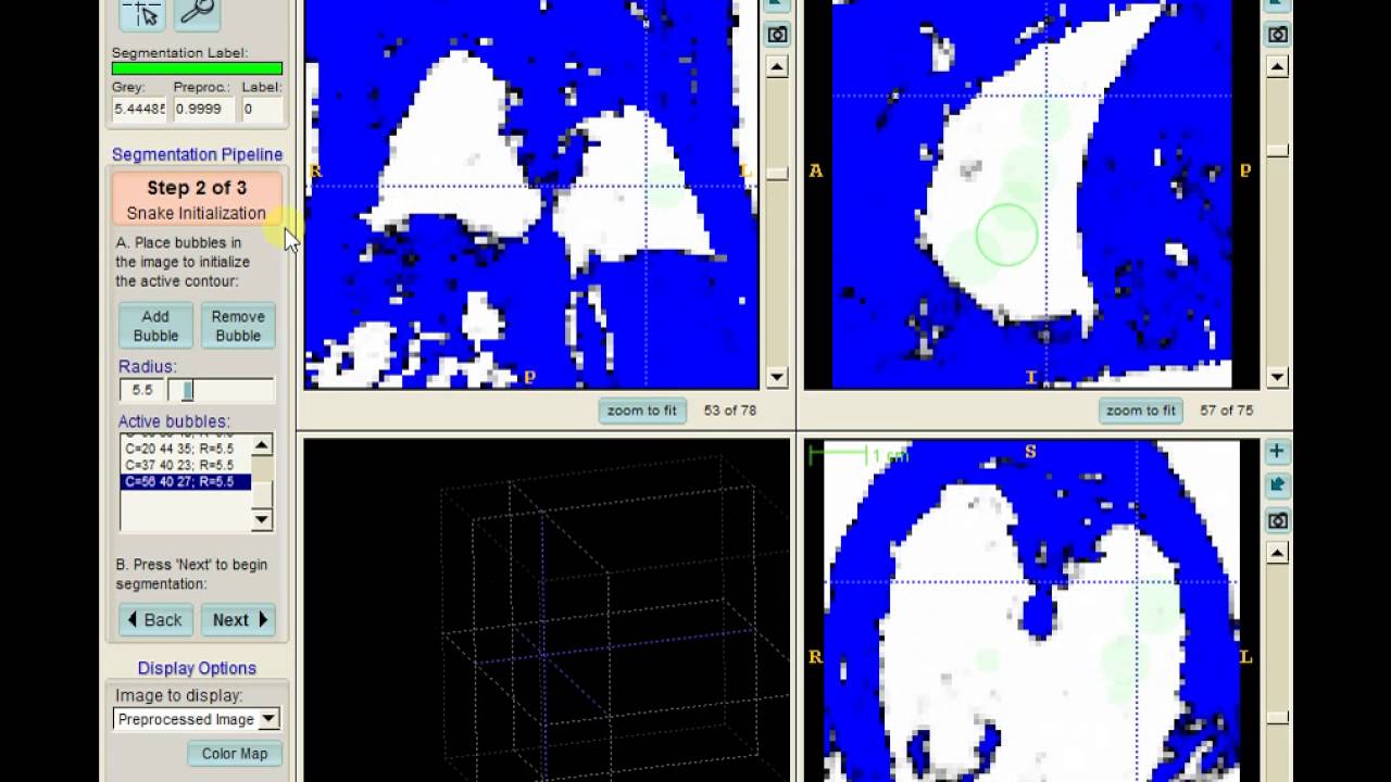 Mouse MRI Lung Segmentation with ITK-Snap