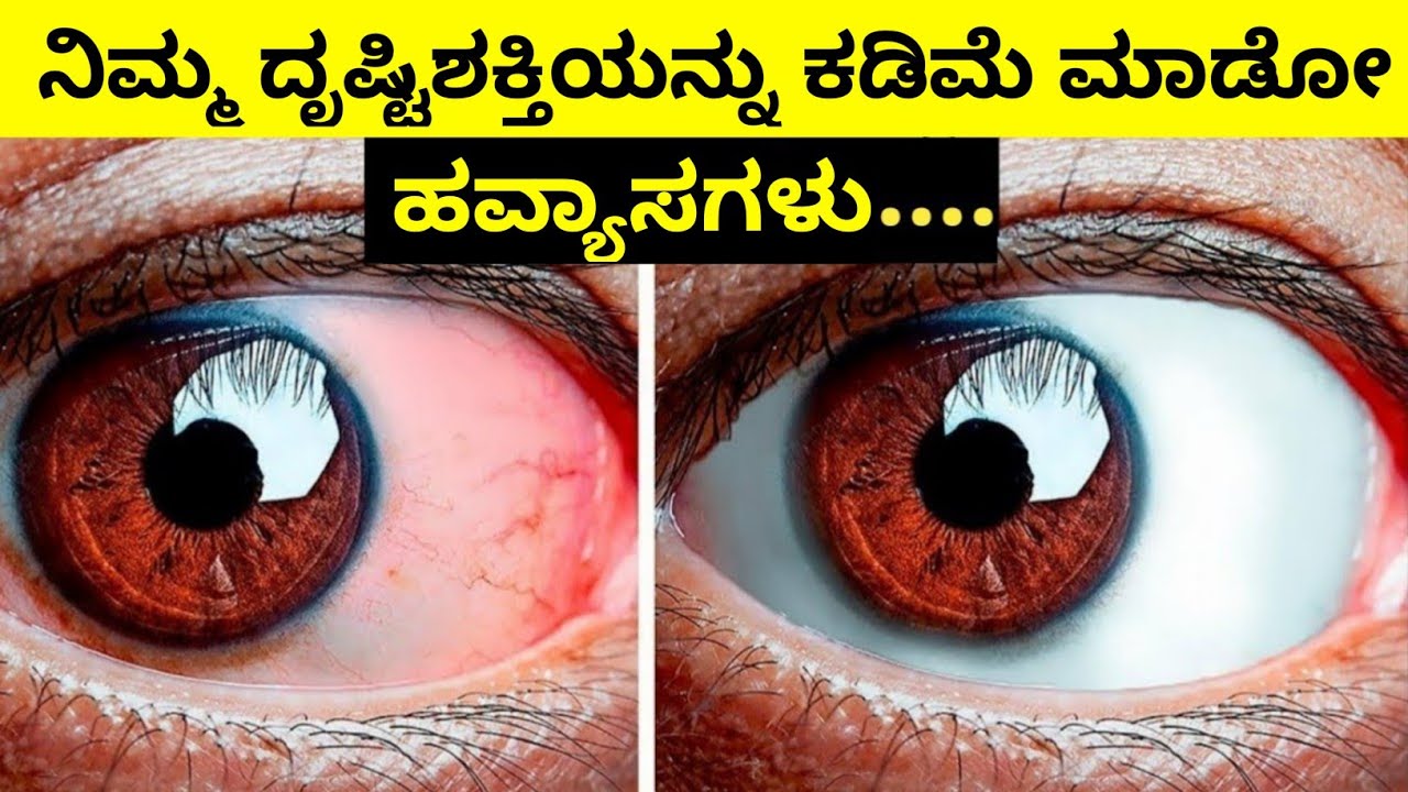 DAILY HABITS THAT DESTROYS YOUR VISION | Almost Everything Kannada | Time for Greatness Kannada