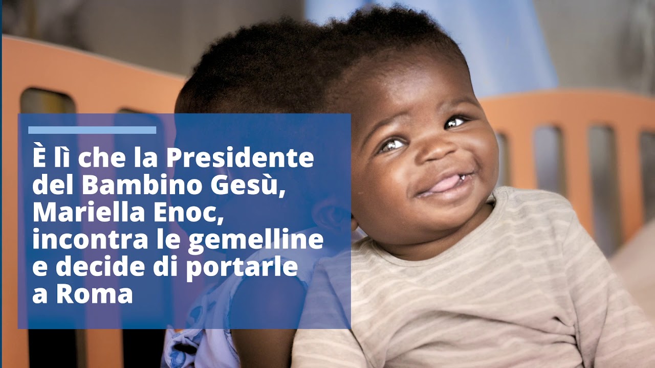 Unite per la testa: separate due gemelle siamesi al Bambino Gesù
