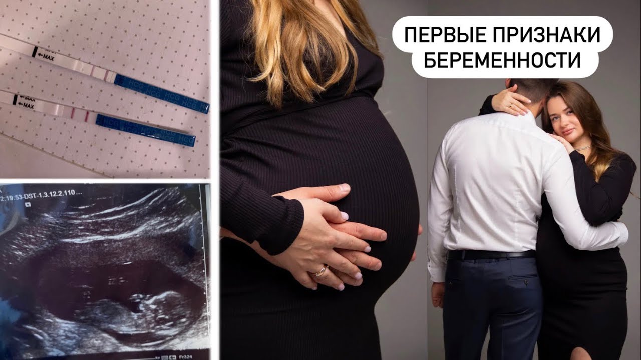 ПЕРВЫЕ ПРИЗНАКИ БЕРЕМЕННОСТИ ДО ЗАДЕРЖКИ 🤰| КАК Я УЗНАЛА О БЕРЕМЕННОСТИ И КАК РАССКАЗАЛА МУЖУ
