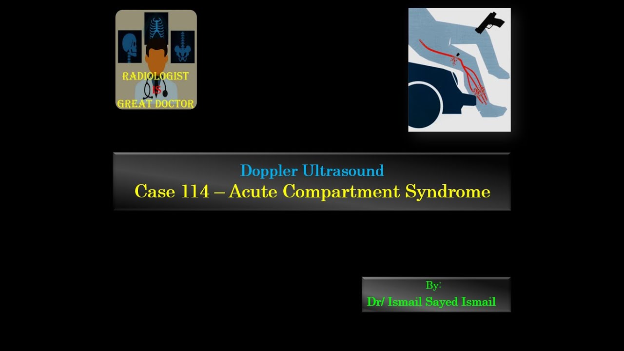 Ultrasound Case 114 - Acute Compartment Syndrome