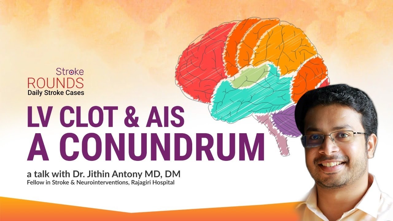 LV Clot and AIS Stroke Rounds 19
