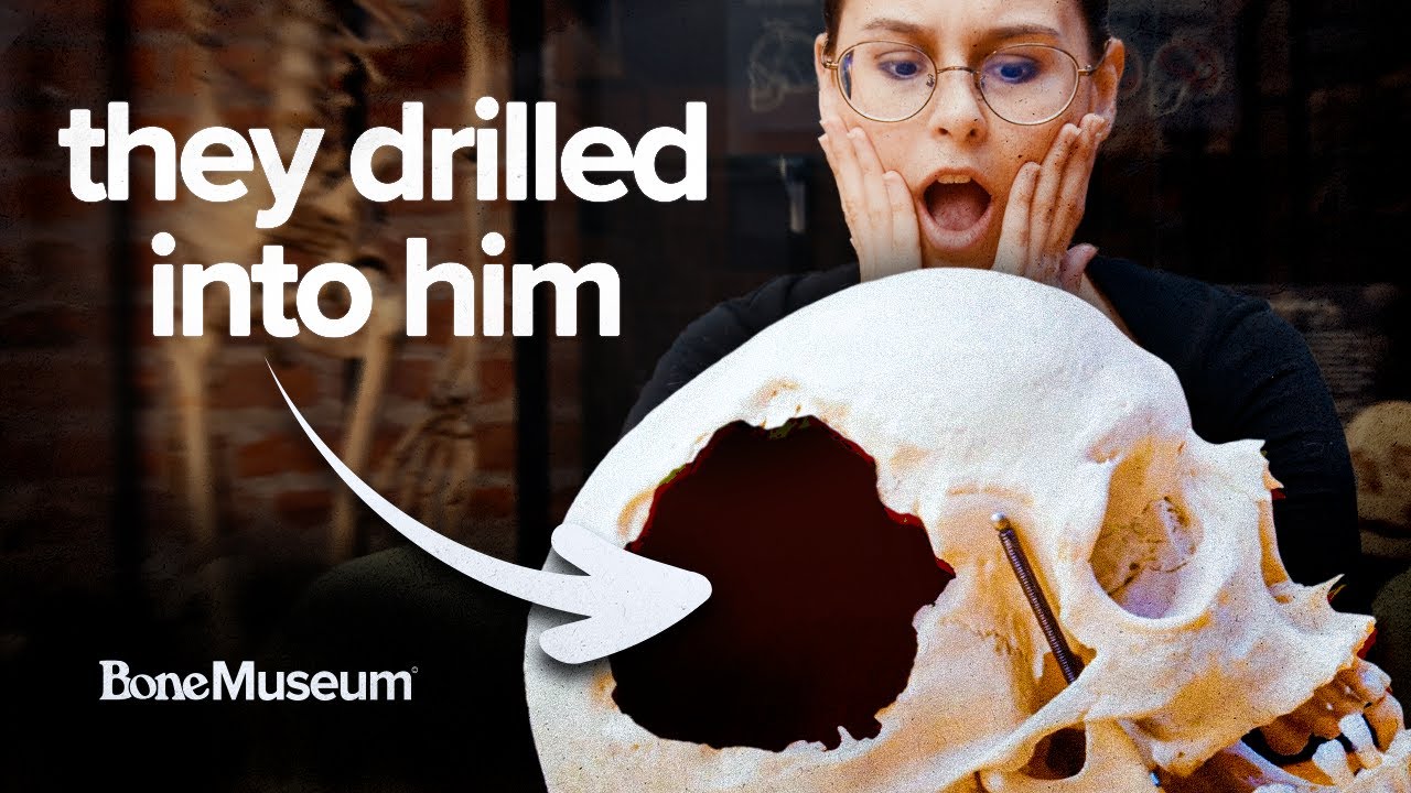 10,000 Years of DRILLING Into People's SKULLS!?