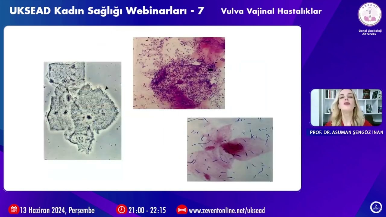 UKSEAD Kadın Sağlığı Webinarları-7 Vulva Vajinal Hastalıklar