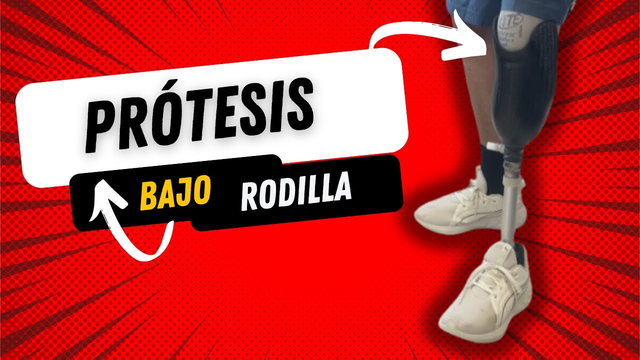 Guía Completa de Prótesis Transtibial: Función, Cuidado y Consejos