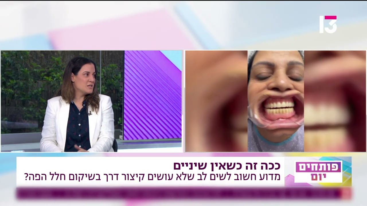 היזהרו לפני שאתם מבצעים השתלת שיניים אול און 4
