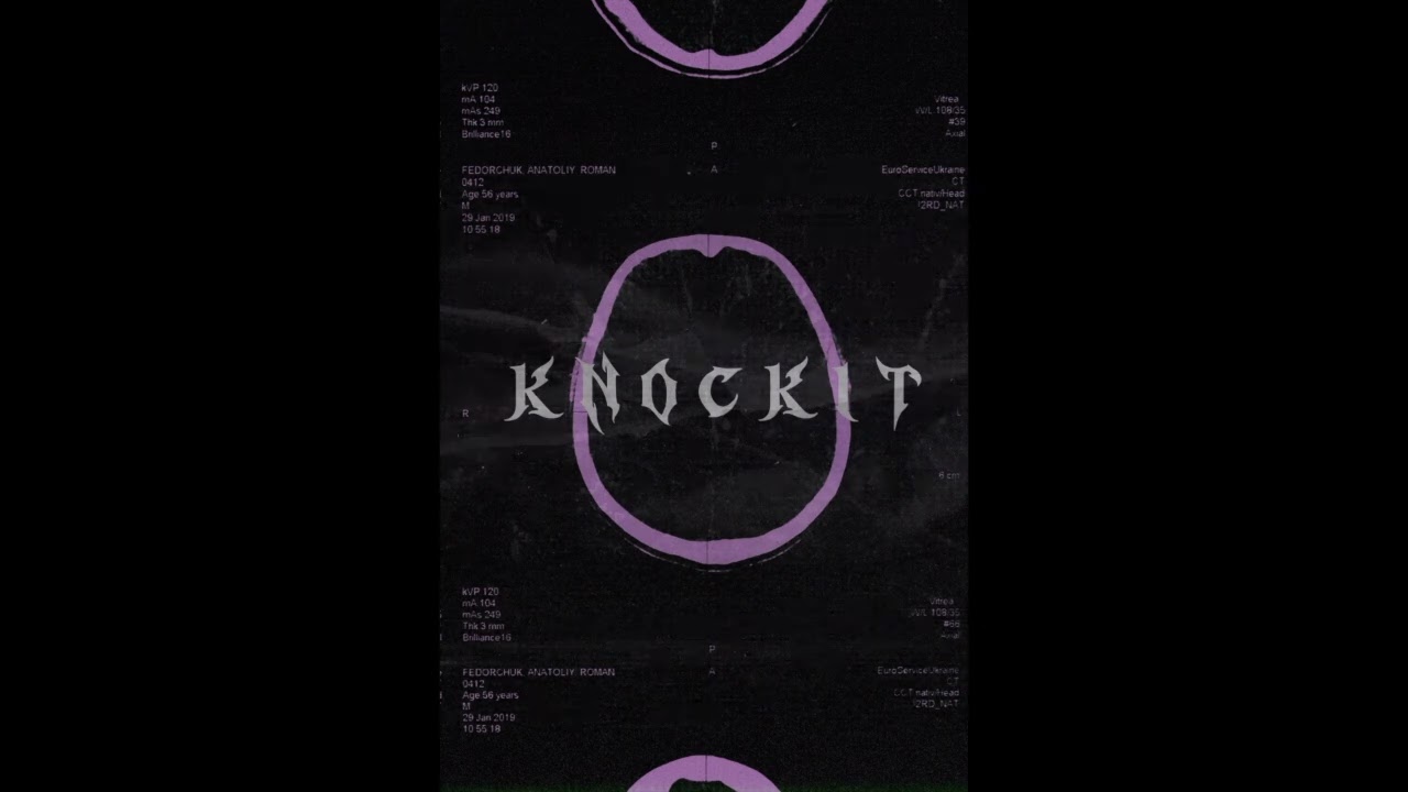 Elixes- KNOCK IT