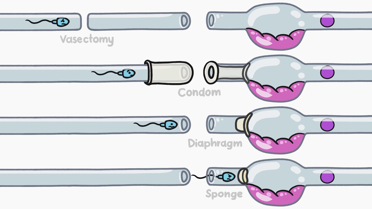 How Does Birth Control Work?