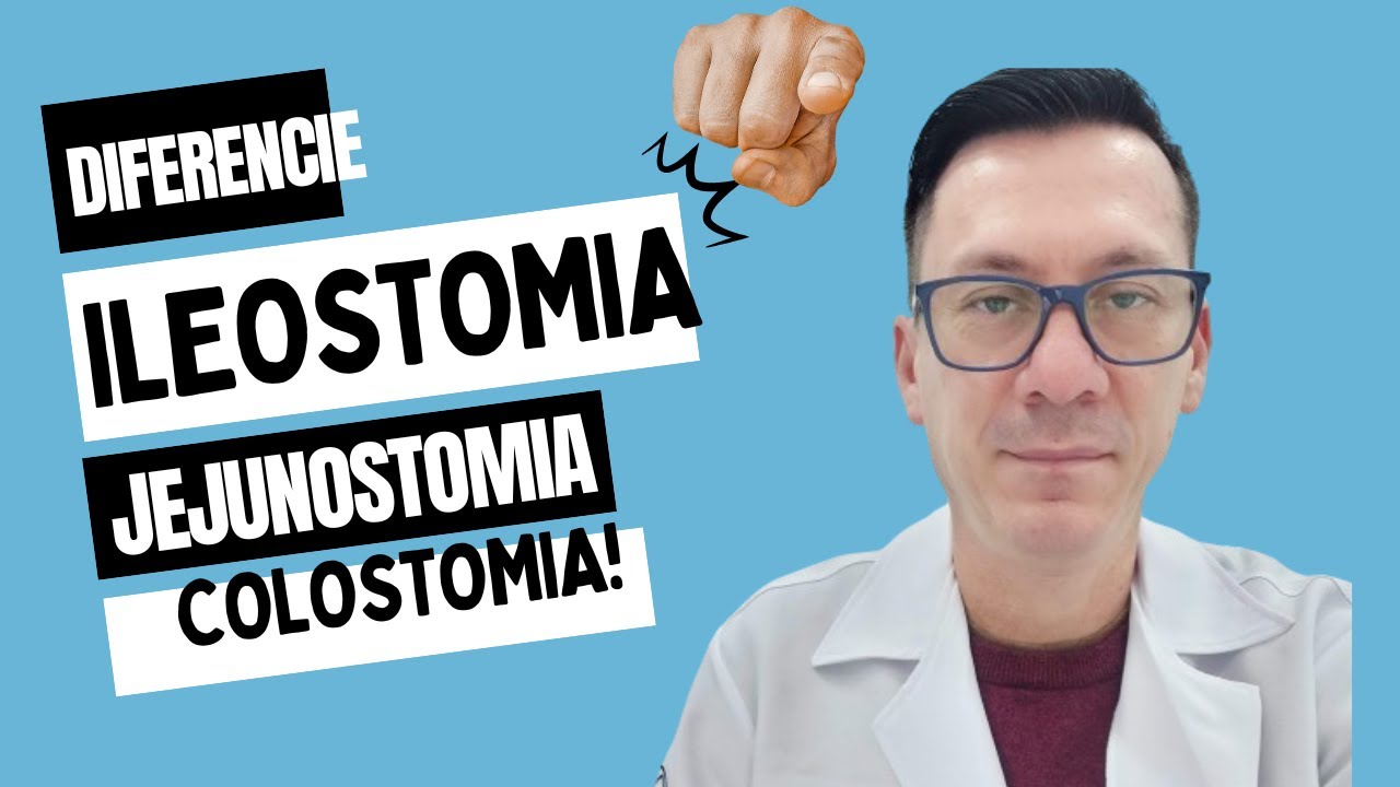 🎥 ILEOSTOMIA, COLOSTOMIA E JEJUNOSTOMIA: ENTENDA AS DIFEREN&Ccedil;AS E INDICA&Ccedil;&Otilde;ES