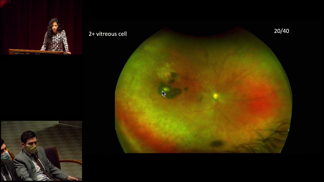 Retina Imaging - November 17, 2021