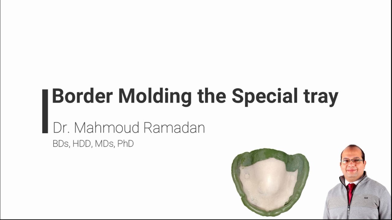 16- Secondary impression of upper arch. Part 2: Border molding the special tray