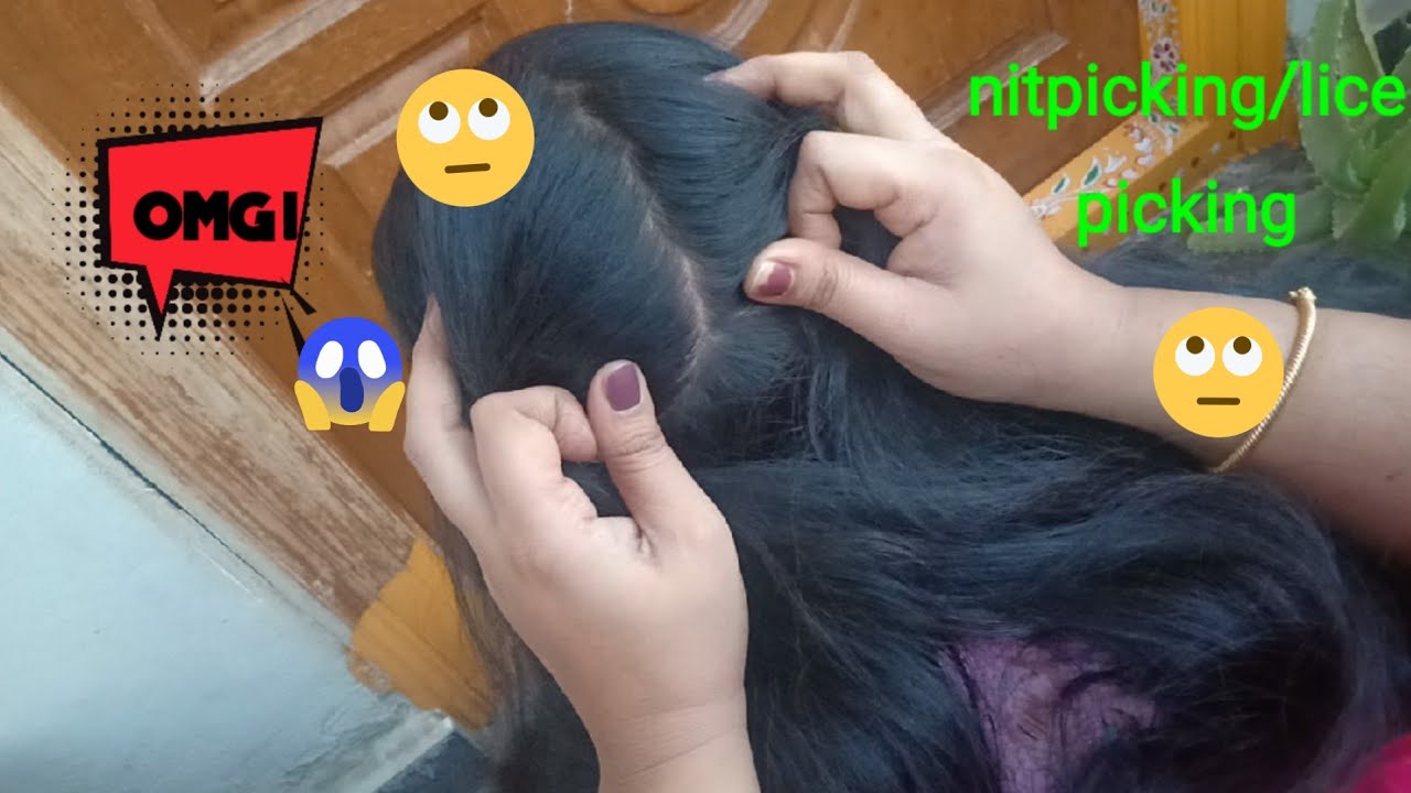 Traditional head lice &nitpicking|nitpicking with real sound|nit/lice picking|withhands|haircracking