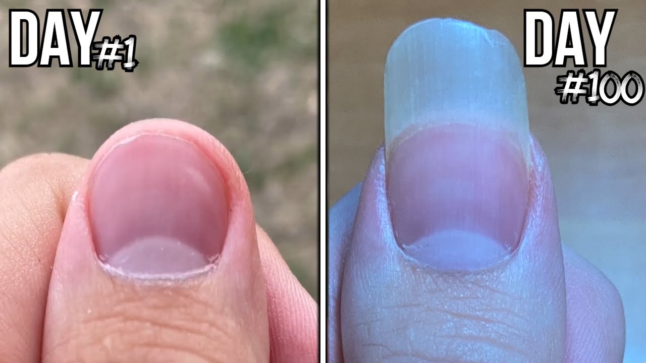 100 Days Of Fingernail Growth - Time Lapse