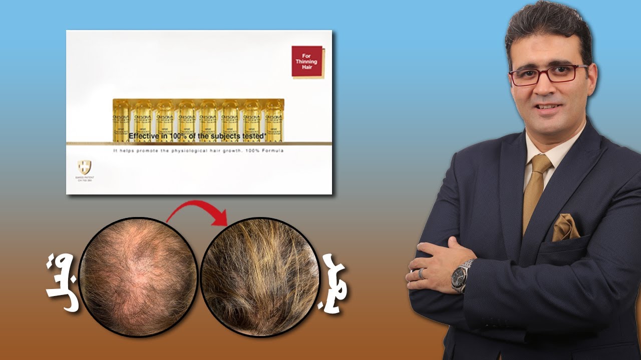 أقوى أمبولات لإنبات الشعر وعلاج الفراغات