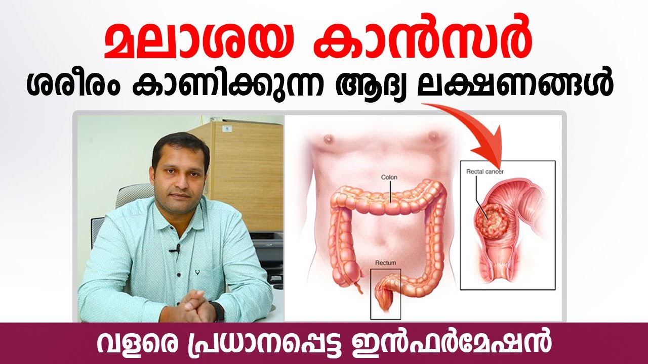 മലാശയ കാൻസർ ശരീരം ആദ്യം കാണിക്കുന്ന ലക്ഷണങ്ങൾ | Colon Cancer Malayalam | Arogyam