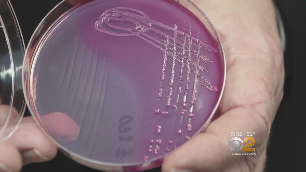 E. Coli Outbreak Linked To Romaine Lettuce Spreads
