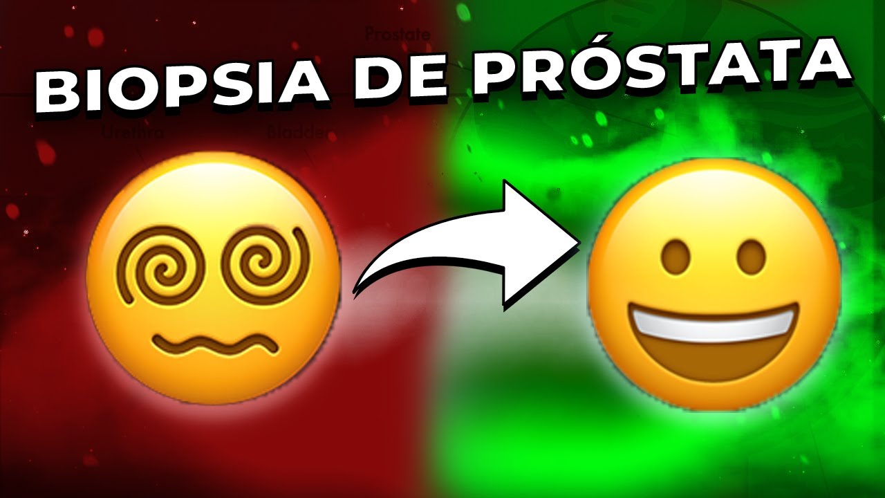 Безопасна ли биопсия простаты? 😥 — Уролог объясняет