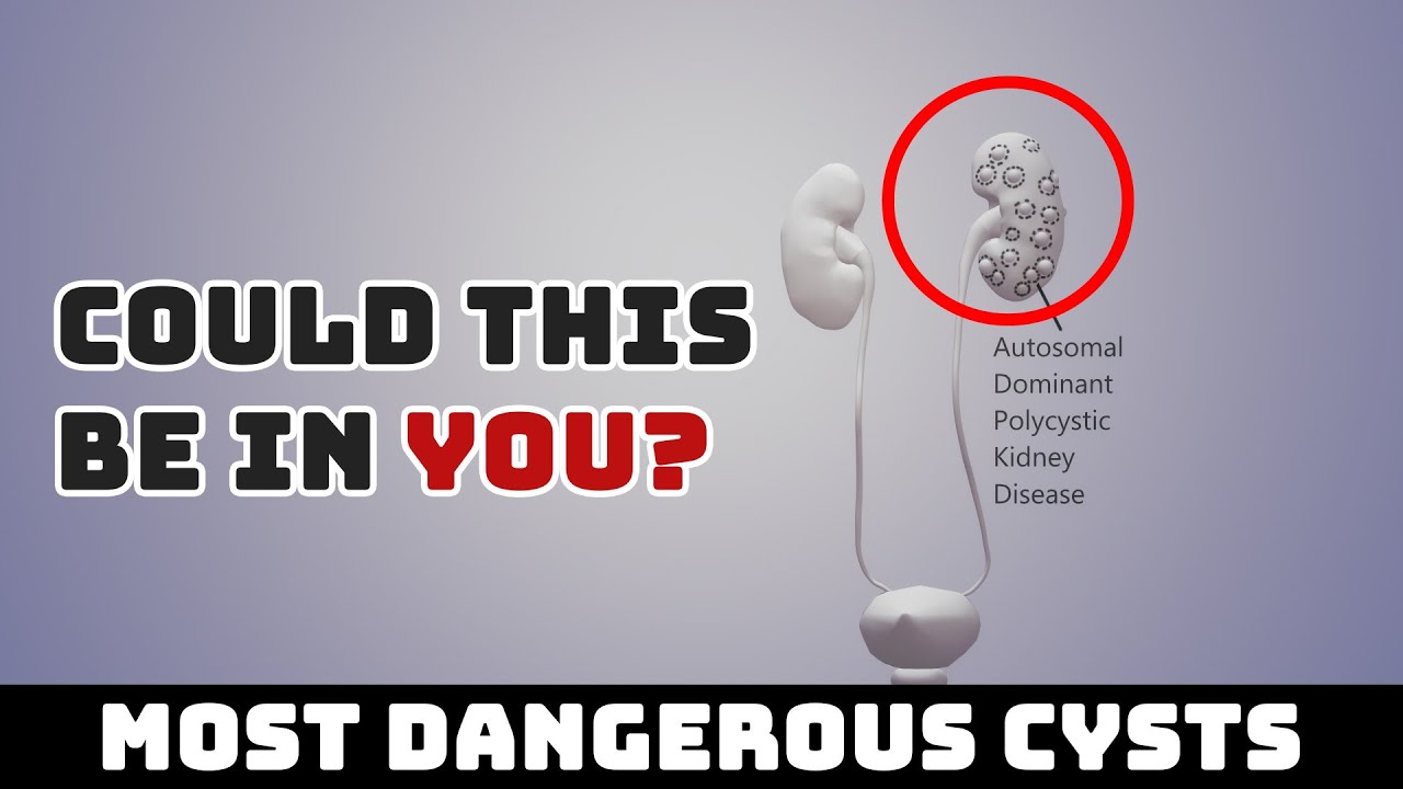 Comparison: Most Dangerous Cysts