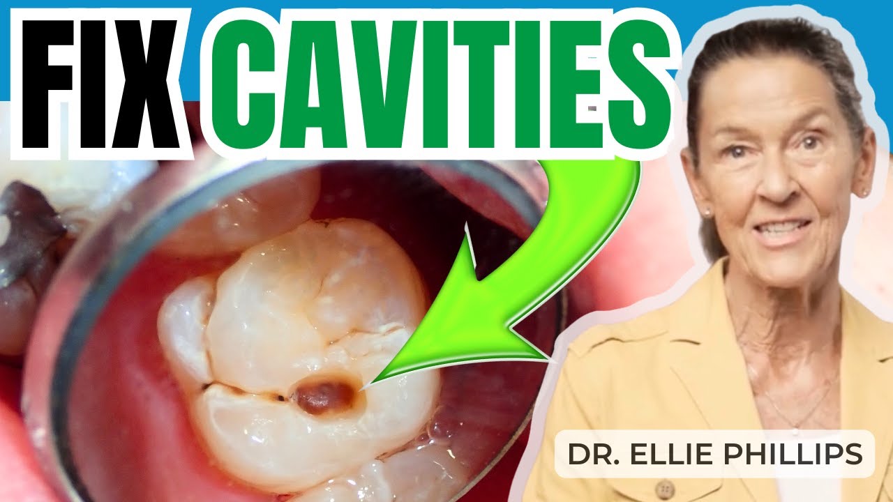 Can You Heal Cavities?
