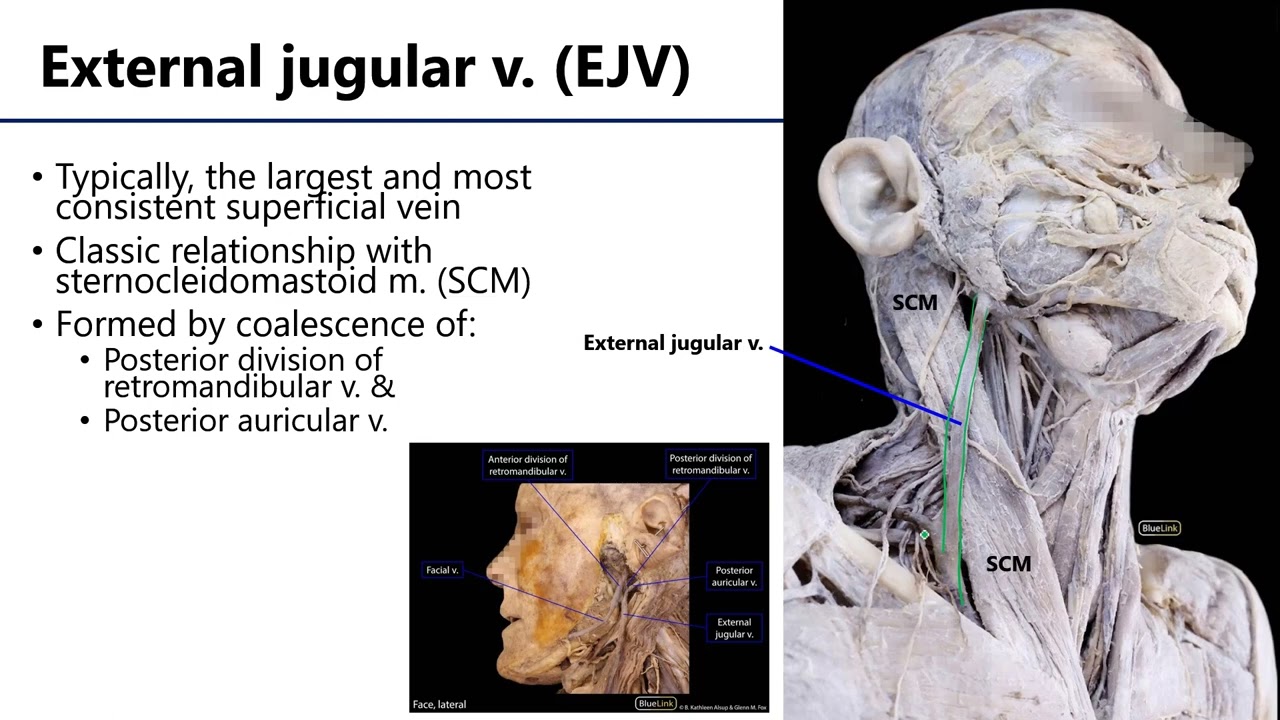 LO4 Veins of Neck