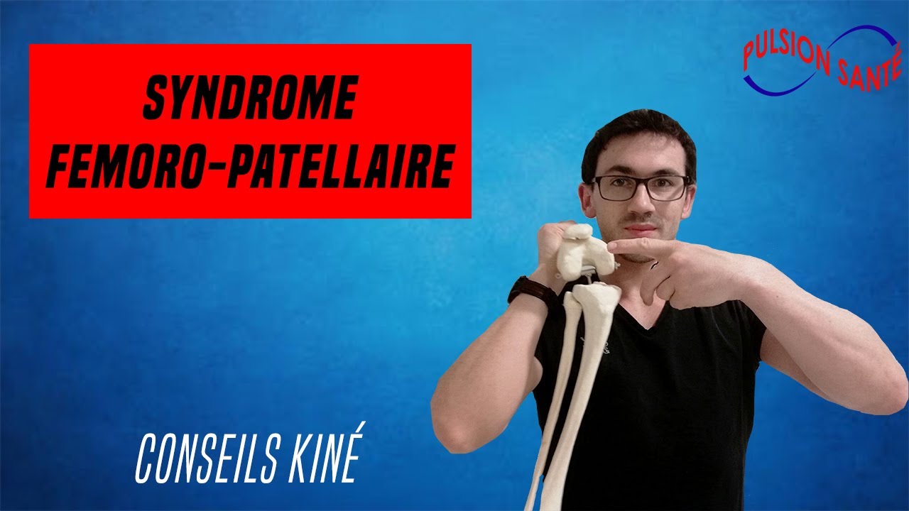Soigner efficacement le syndrome fémoro patellaire : Conseil KINE et auto-exercices