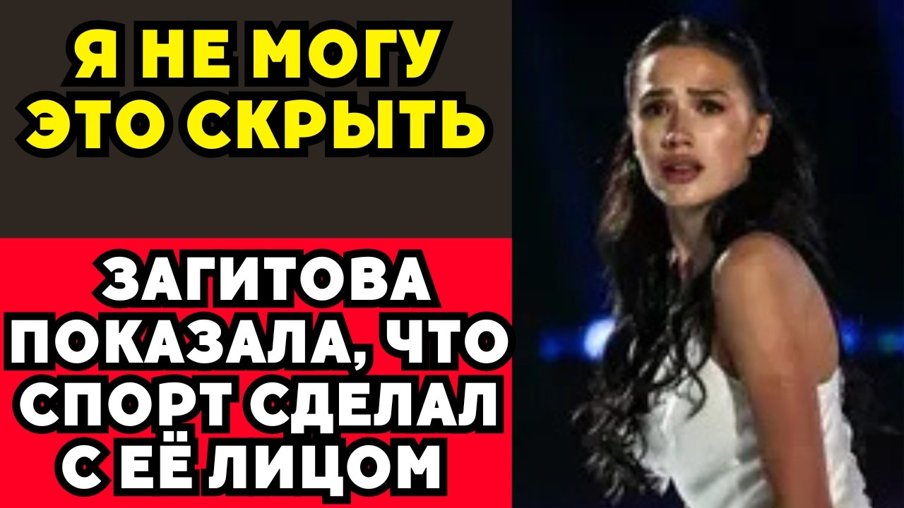 «Косметологи, Помогите» — Загитова Призналась В Том, О Чём Молчала Годами!