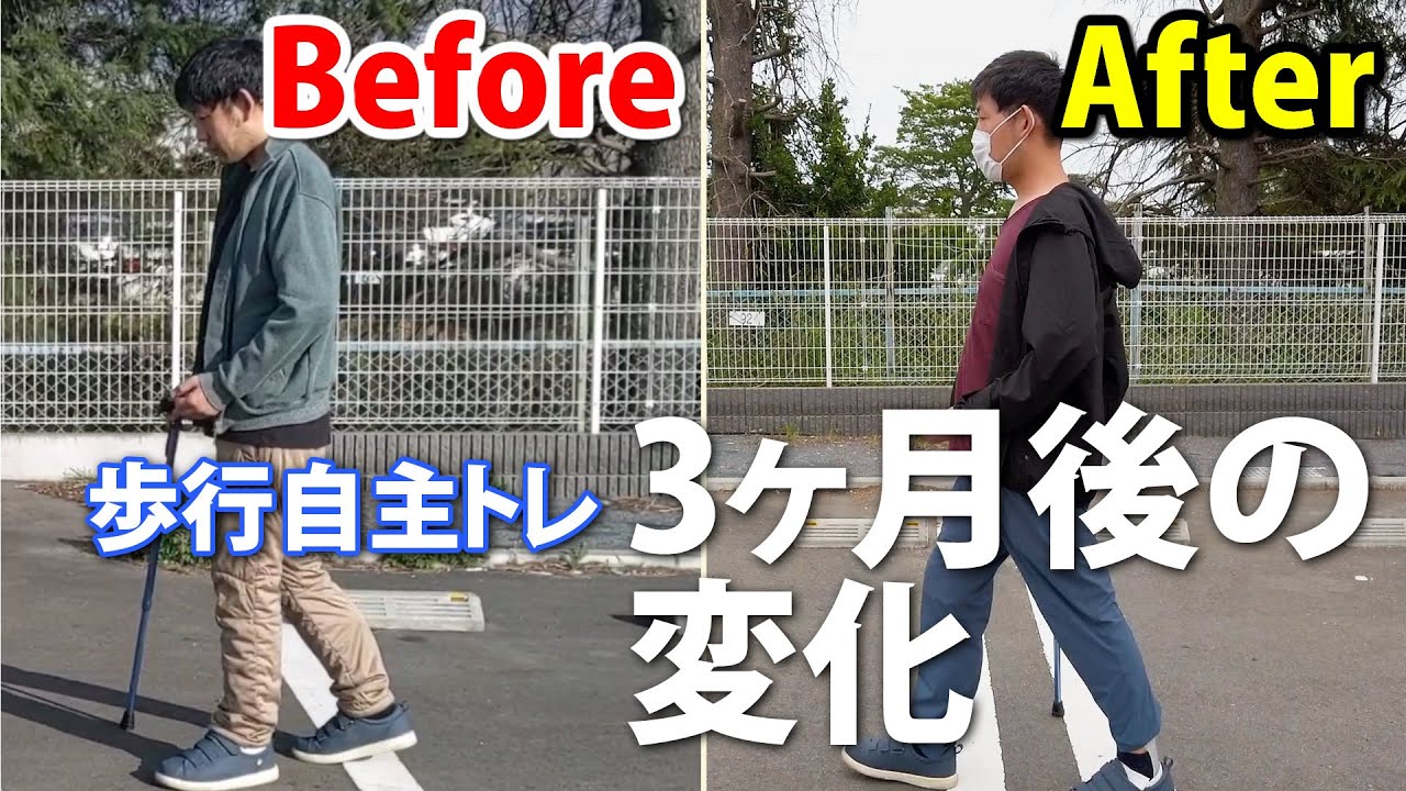 【片麻痺歩行記録】退院から三ヶ月、歩行の変化をお見せします！