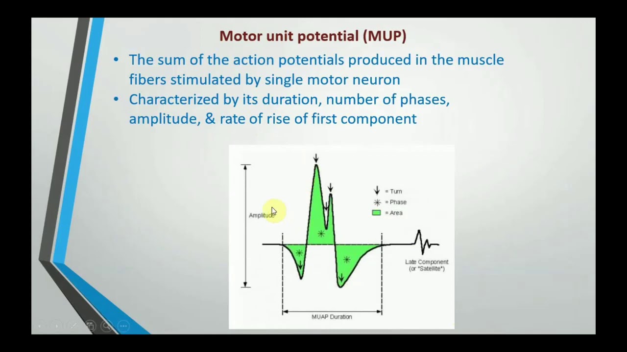 Electromyography EMG