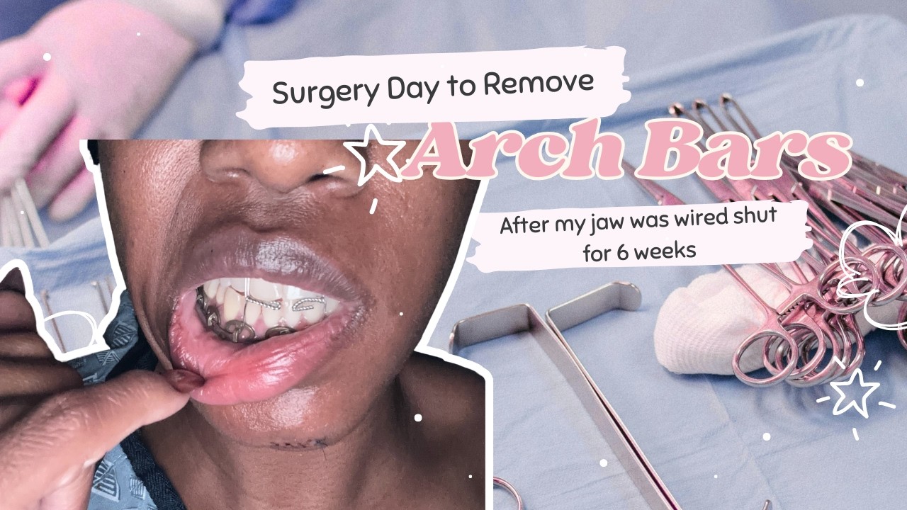 Pre & Post Surgery: Arch Bar Removal After Breaking My Jaw