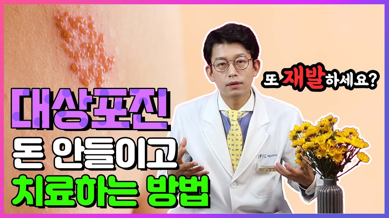 대상포진 왜 생길까? 재발 없이 치료하는 방법 소개해드립니다