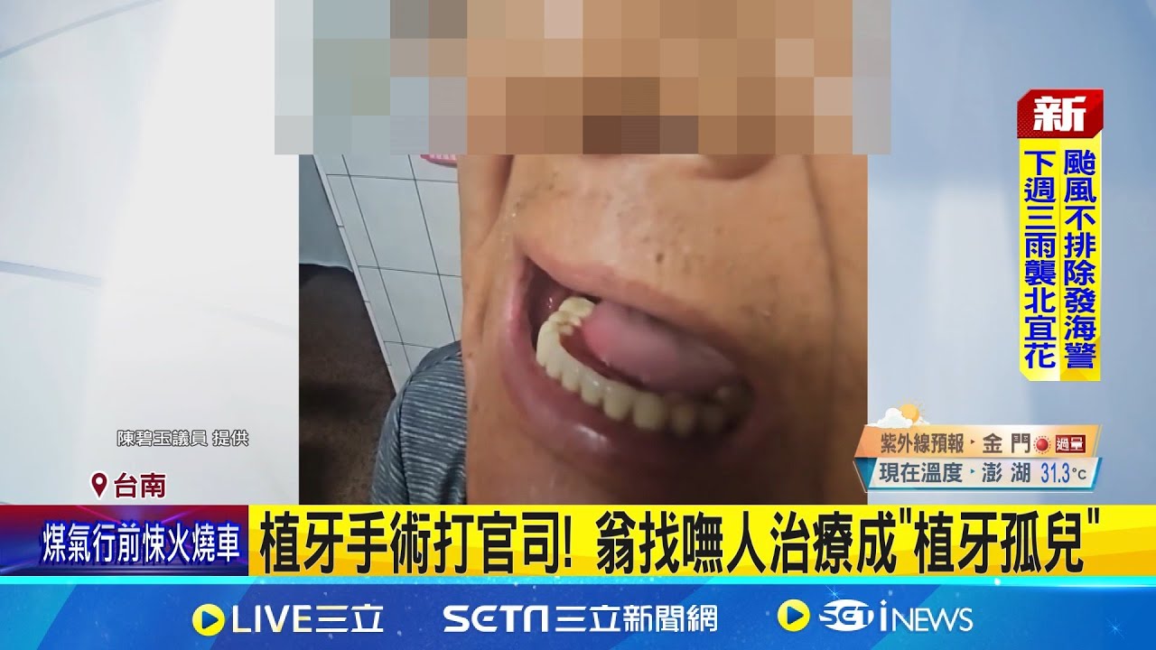 植牙手術打官司! 翁找嘸人治療成