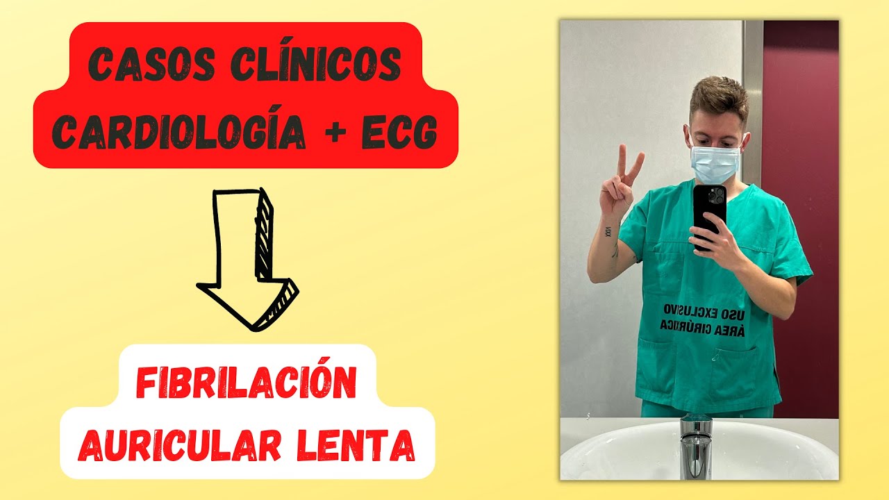 APRENDE RAZONANDO😎: FA LENTA (Caso clínico + ECG)😰