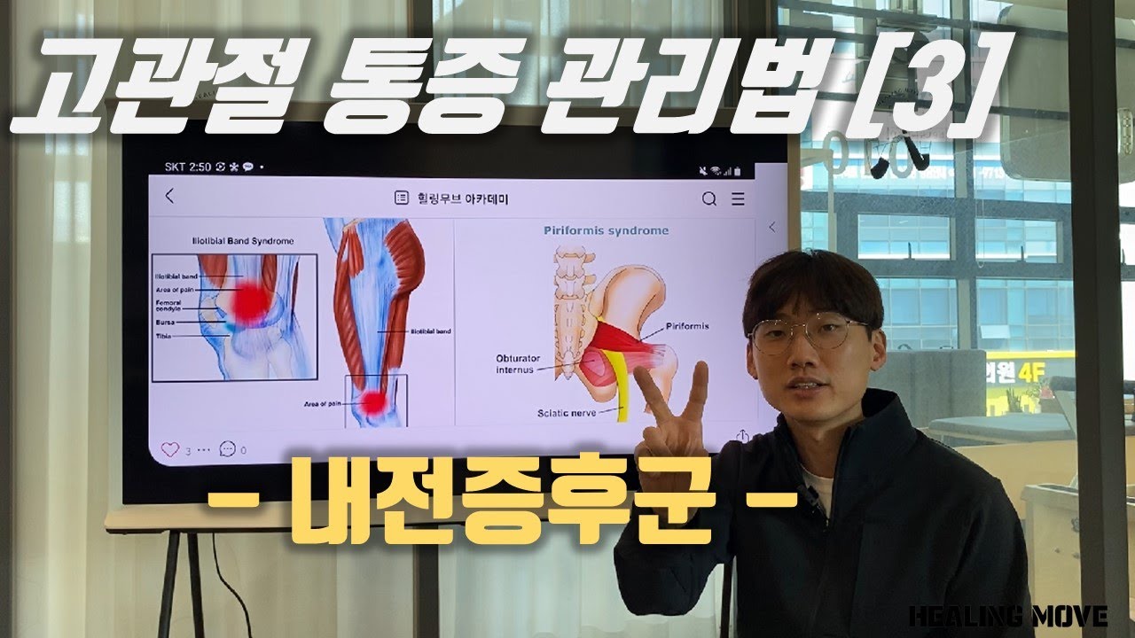 골반이 크거나 X다리가 있으면서 고관절이 아픈분들 주목! / 원인과 해결방법까지 다 알려드려요 /고관절 통증 3편