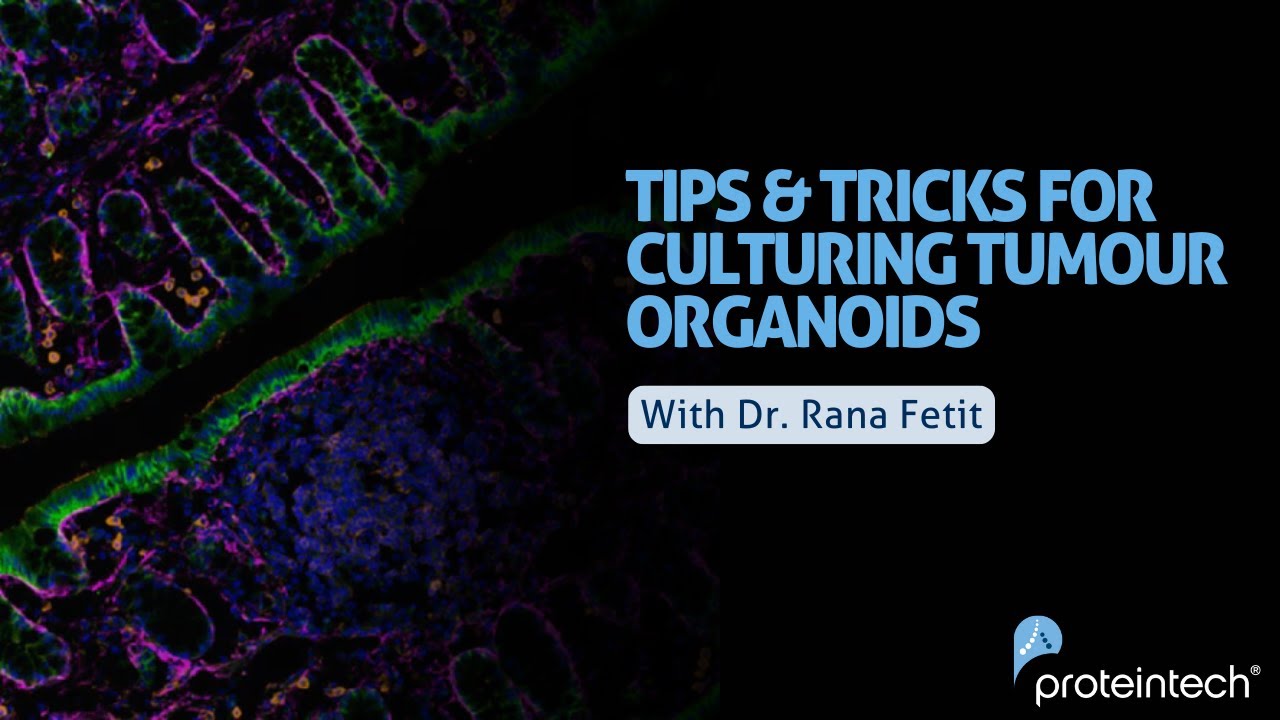 Tips and Tricks for Culturing Tumour Organoids