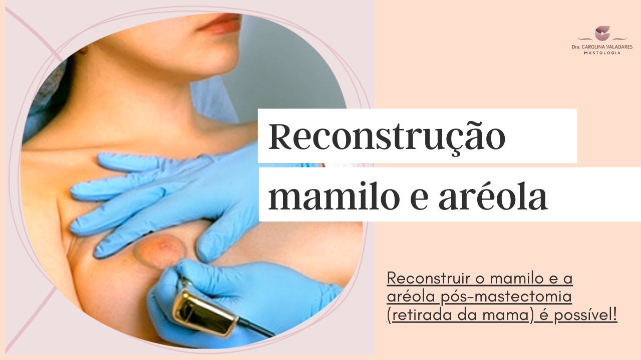 Reconstrução do mamilo e aréola